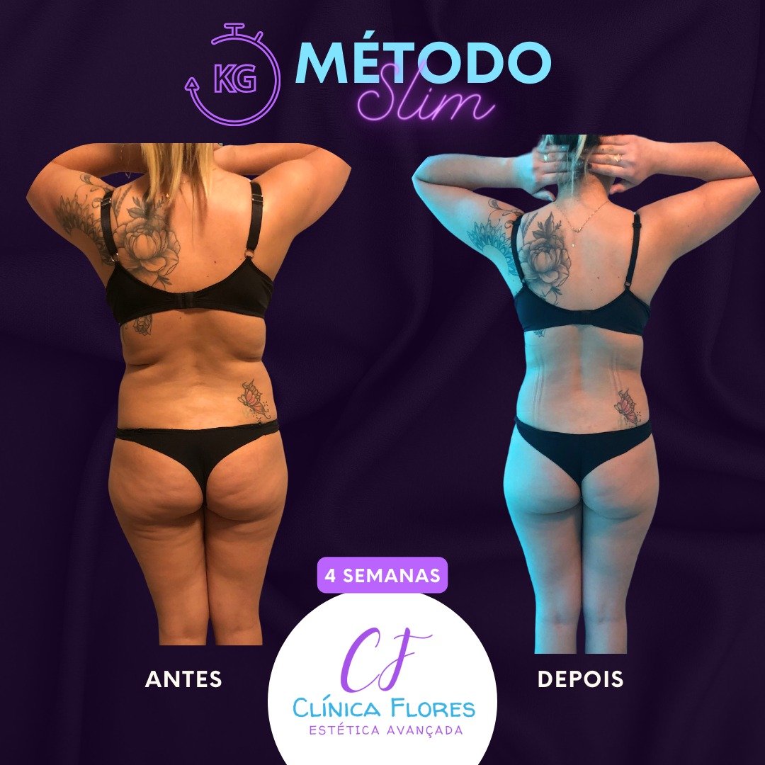 Método Slim — 4 Semanas
