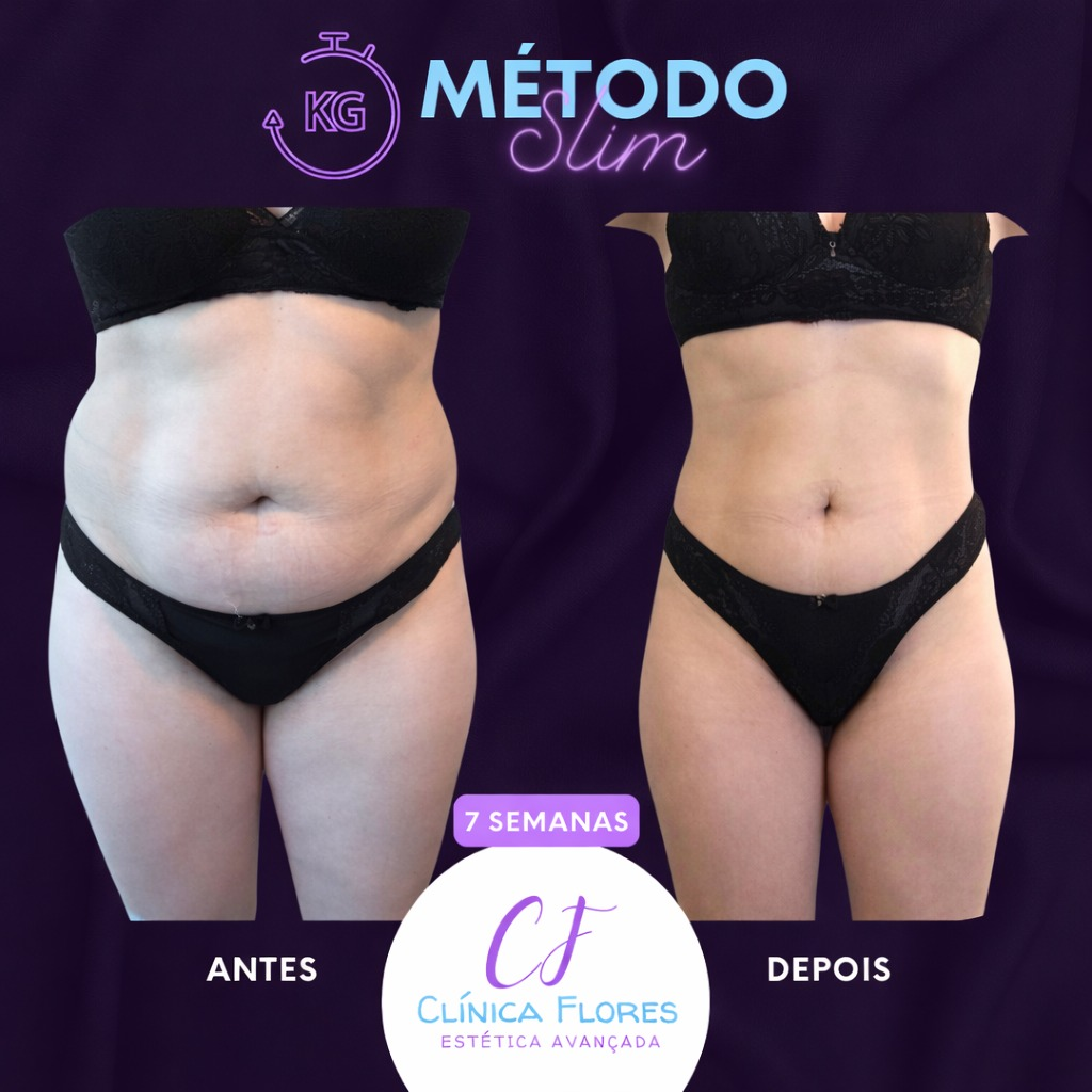 Método Slim — 7 Semanas
